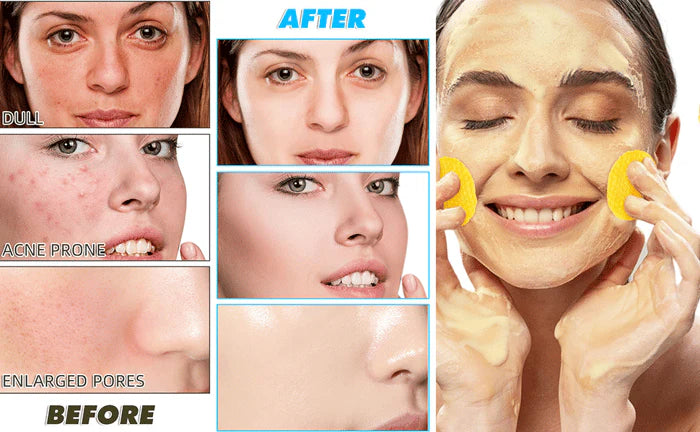 TURMERIC & KOJIC ACID PADS