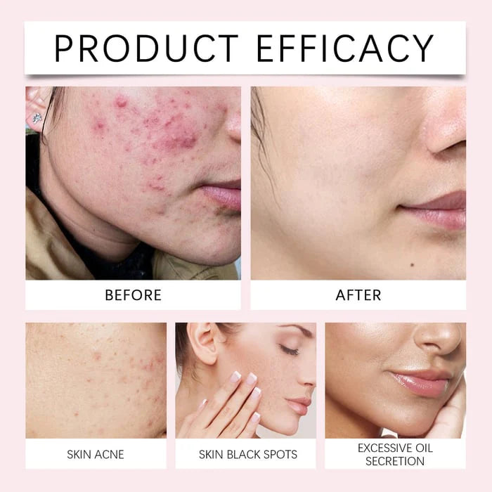 TURMERIC & KOJIC ACID PADS